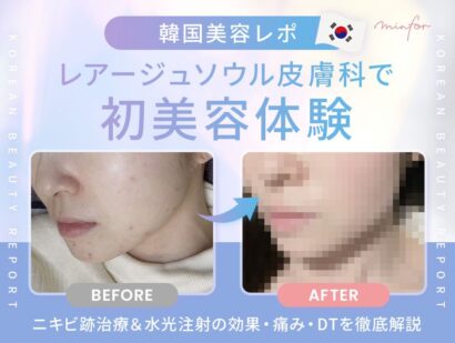 【韓国美容レポ】レアージュソウル皮膚科で初美容体験！ニキビ跡治療＆水光注射の効果・痛み・DTを徹底解説