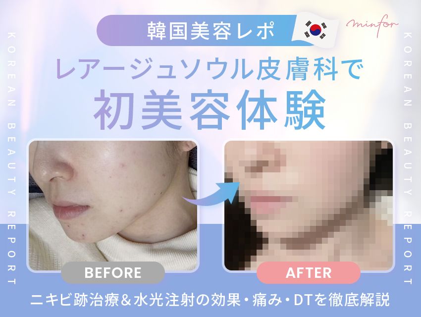 【韓国美容レポ】レアージュソウル皮膚科で初美容体験！ニキビ跡治療＆水光注射の効果・痛み・DTを徹底解説