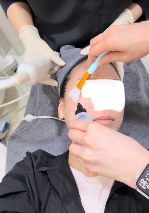 alt="デンサティ施術中の様子、顔にオイルを塗っているシーン"