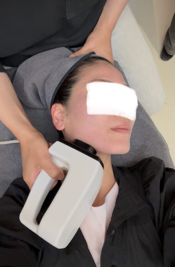 alt="インモード施術中、フェイスラインに高周波を照射する様子(正面からのアングル)"