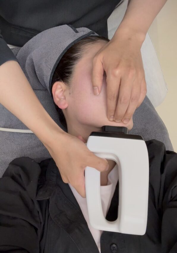 alt="インモード施術中、フェイスラインに高周波を照射する様子(側面からのアングル)"