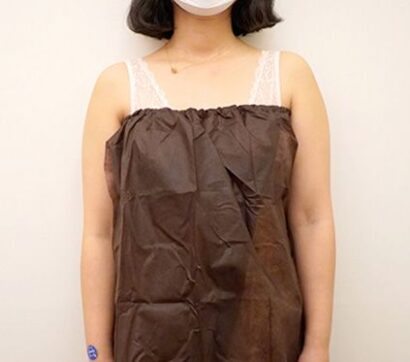 CAT注射（二の腕） BEFORE