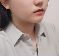 フェイスライン AFTER