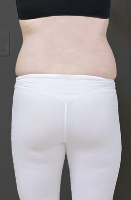 허파고리（ホパゴリ） BEFORE