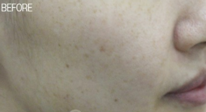 デュアルトーニング BEFORE