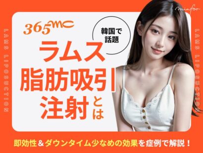 【韓国で話題】365mcのラムス脂肪吸引注射とは？即効性＆ダウンタイム少なめの効果を症例で解説！
