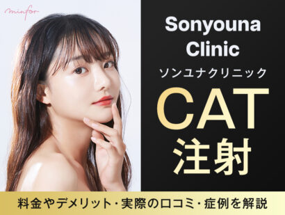 ソンユナクリニックのCAT注射は効果なし？料金やデメリット・実際の口コミ・症例を解説