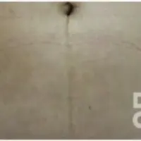 肉割れ治療 AFTER