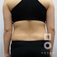 ピンク丸剤 BEFORE