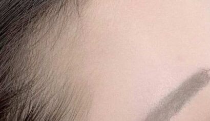 ヘアライン BEFORE