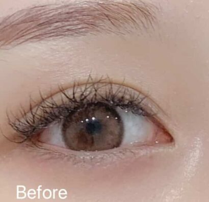 涙袋アートメイク BEFORE