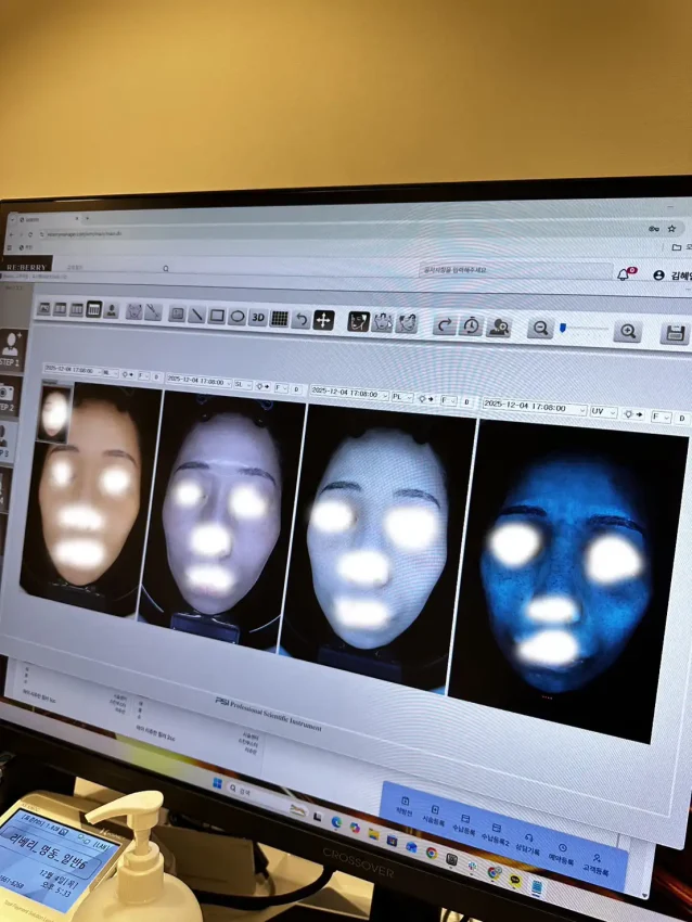 リベリクリニック肌診断03