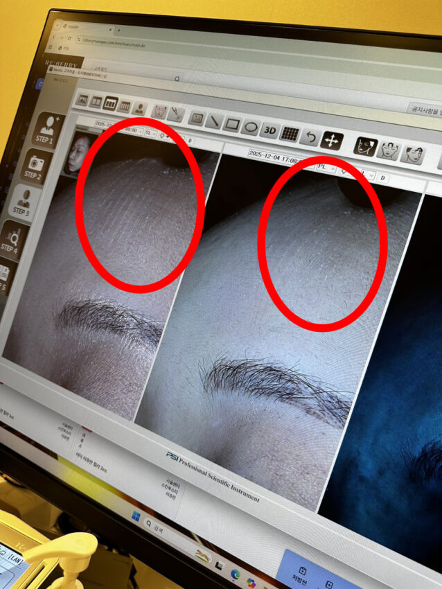 リベリクリニック肌診断02