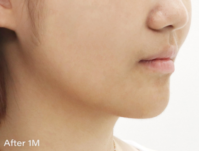 Ai リフティング AFTER