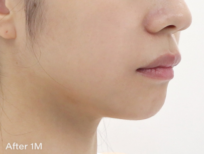 Ai リフティング AFTER