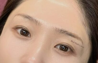 Combo Brow BEFORE