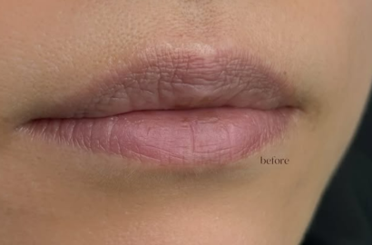 Lip Blush BEFORE