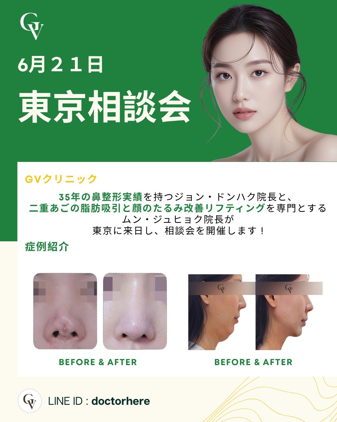 GVクリニック 相談会