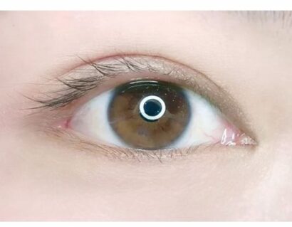 Eyeline BEFORE
