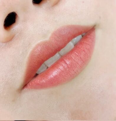Lip AFTER