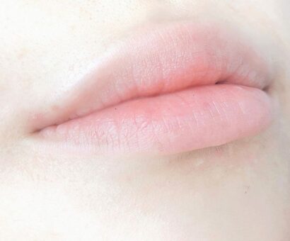 Lip BEFORE