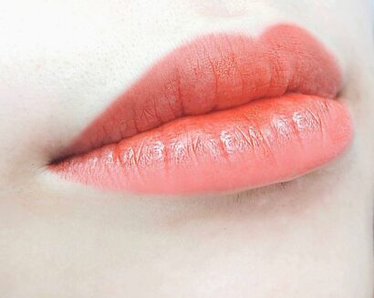 Lip AFTER