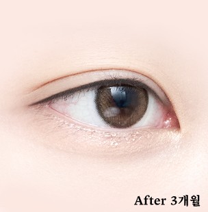 アイライン AFTER