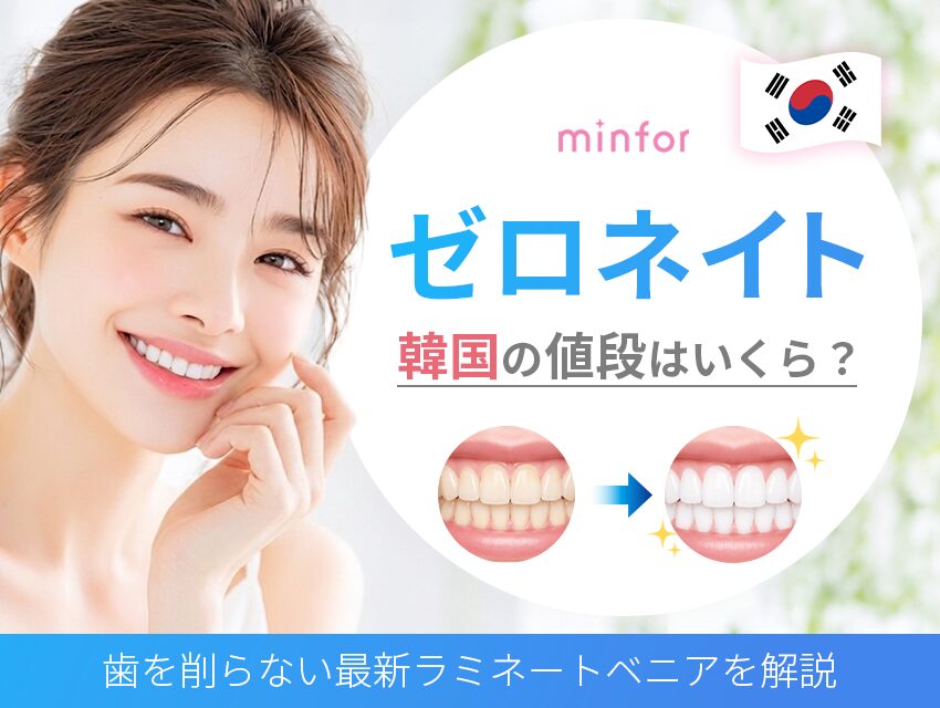 ゼロネイトとは？韓国の値段はいくら？歯を削らない最新ラミネートベニアを解説