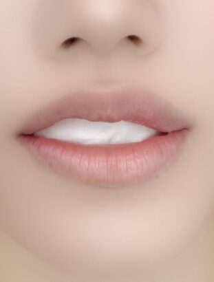 LIP BEFORE