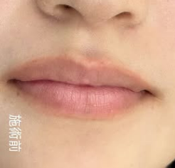 リップアートメイク BEFORE